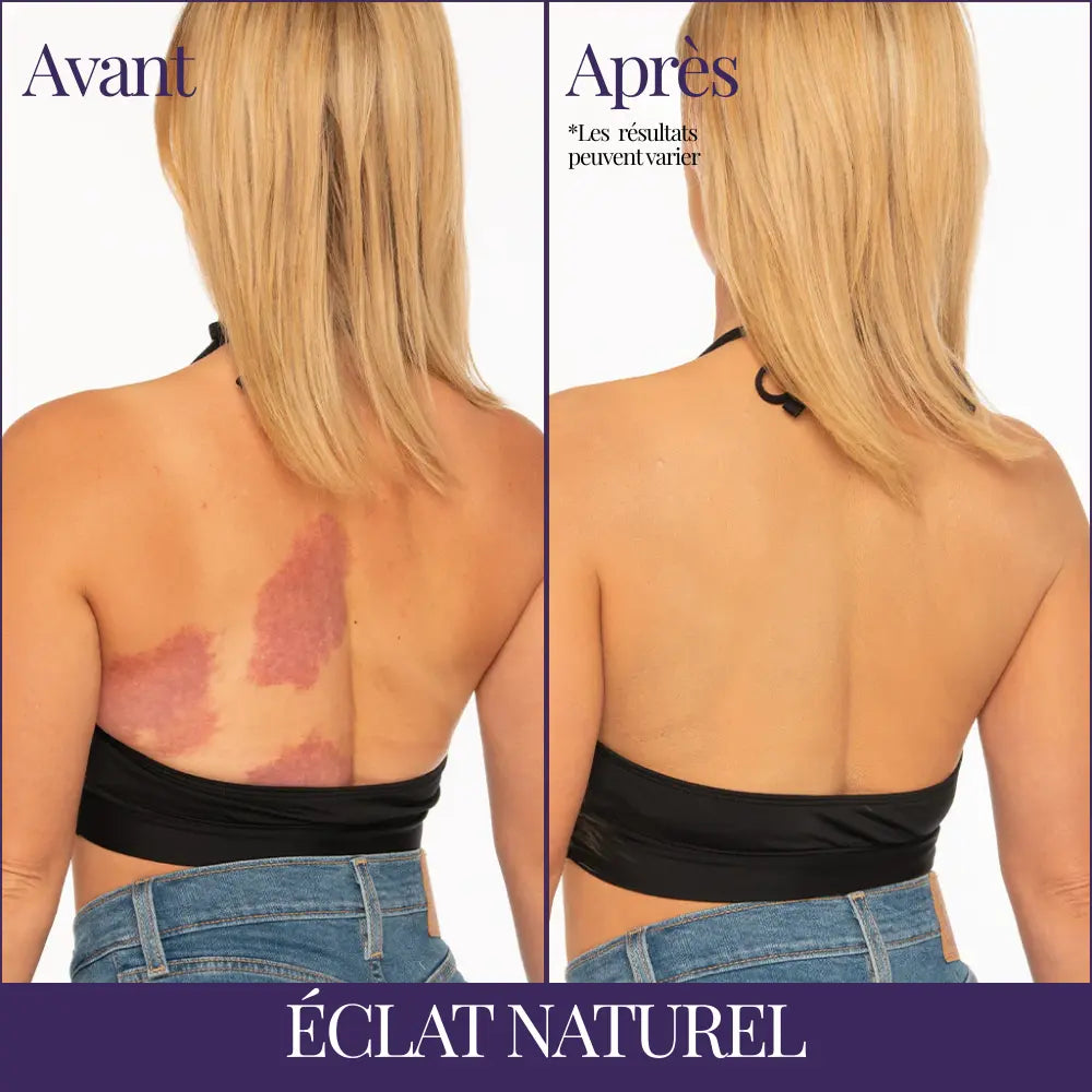 BRONILY® Perfecteur de Teint pour le Corps